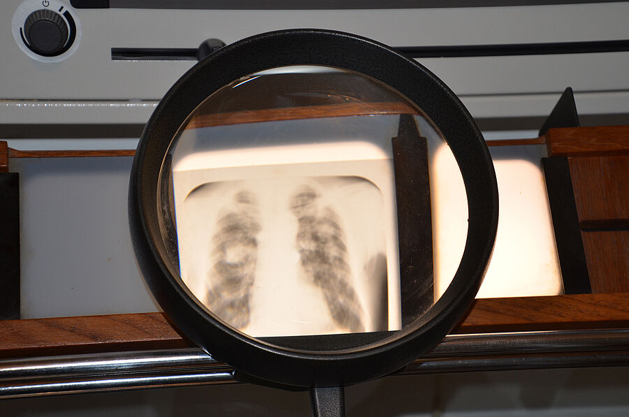 Röntgenschirmbild im Schaukasten mit Vergrößerungsglas - Sollinghaus Weber